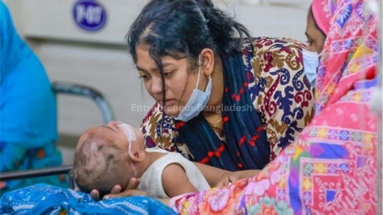 একদিনে হাম উপসর্গে আরও ২ জনের মৃত্যু, ভর্তি ১৩৭৭